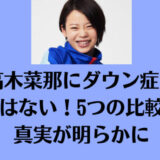 高木菜那にダウン症や整形はない！5つの比較から真実が明らかに